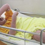 Woman dies after setting herself on fire while protesting against stadium ban