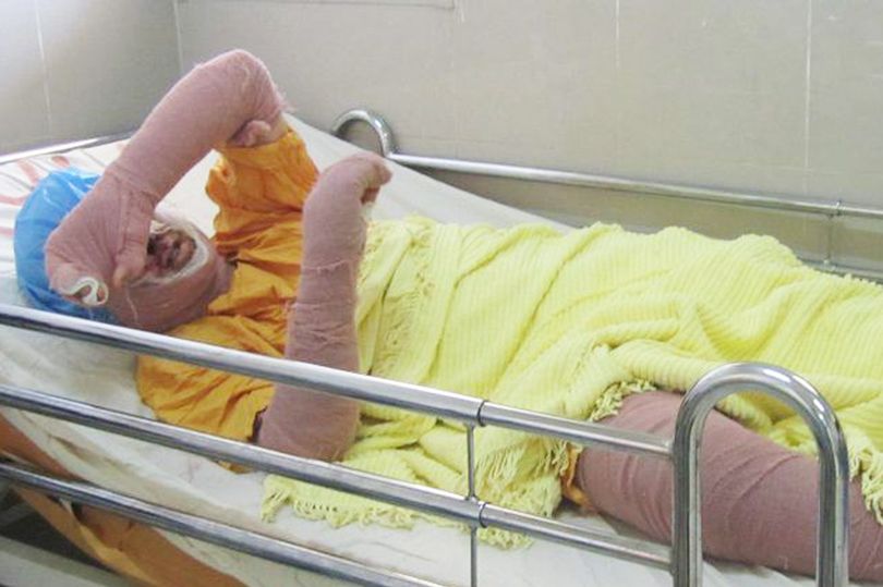 Woman dies after setting herself on fire while protesting against stadium ban