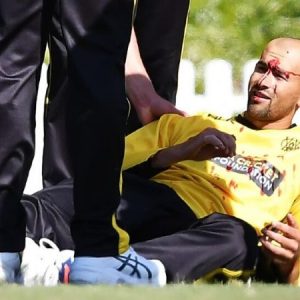 WATCH: Ashton Agar copes horrific blow after dropping brother Wes Agar in March Cup