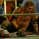 WWE Superstar Edge proves his injury is not a work with graphic pictures