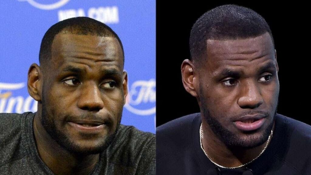 LeBron James hairline