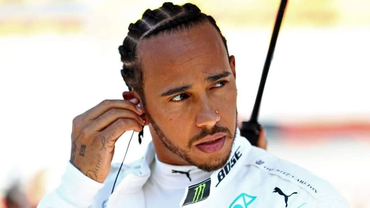 Lewis Hamilton hair transplant