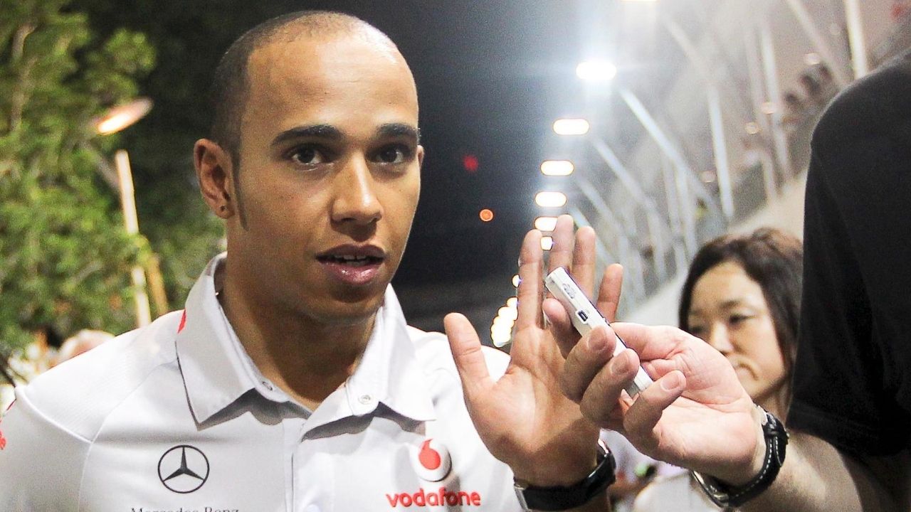 Lewis Hamilton hair transplant