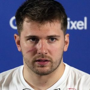 "It's good, makes me look tough": Luka Doncic's witty reply to a reporter when asked about scar on his face