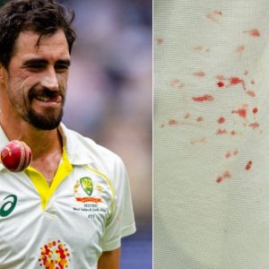 Mitchell Starc finger injury: Mitch Starc finger blood photos from Boxing Day Test