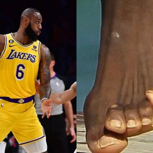 LeBron James Toes: Does the King Need Toe Surgery? Have His Signature LeBrons Caused Foot Deformity?