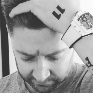 Michael Clarke plastic surgery: Did Michael Clarke undergo plastic surgery due to skin cancer?