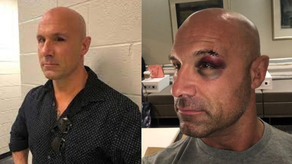 Christopher Daniels eye
