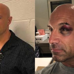 Christopher Daniels eye