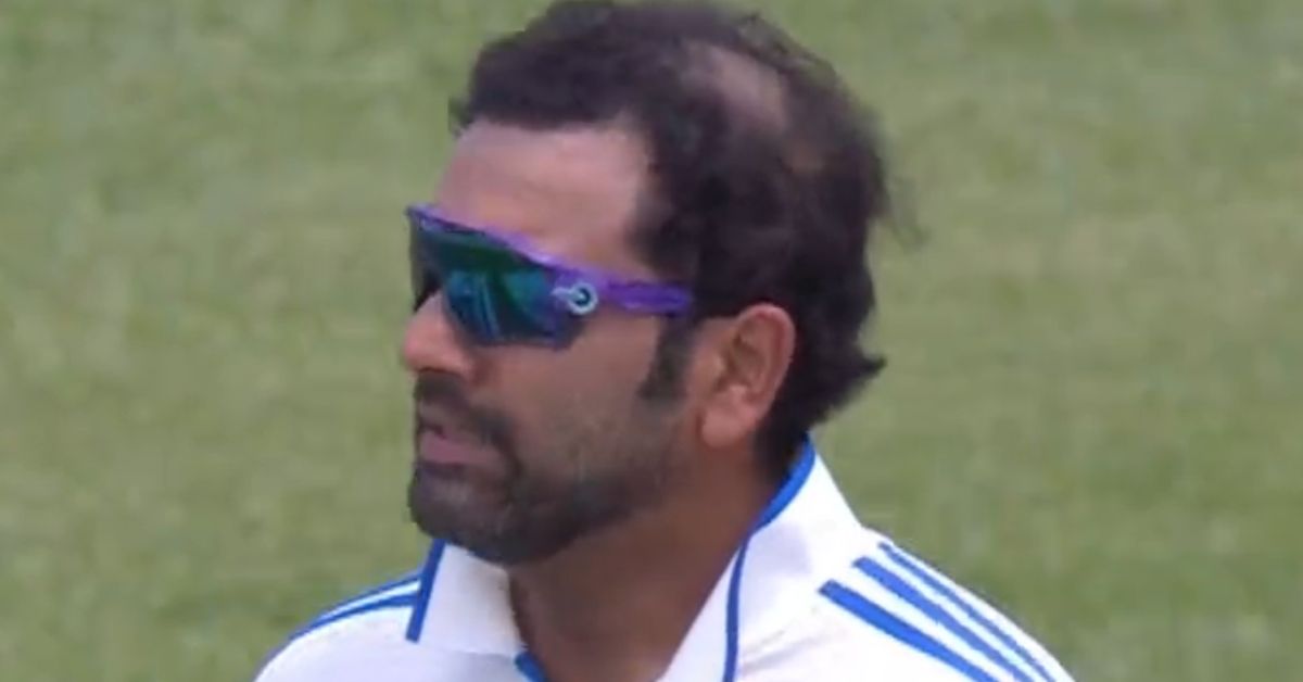 Rohit Sharma Hair Fall: Has Indian Captain Had A Hair Transplant?