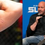 “He Has Family”: Andre Lima ‘Feels Sorry’ for the Opponent Dana White Removed From UFC After the Bite Controversy