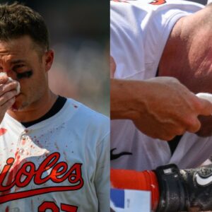 "Toughness Personified": Orioles Fans Left in Awe as Bloodied Catcher Refuses to Exit After 95mph Fastball to Nose