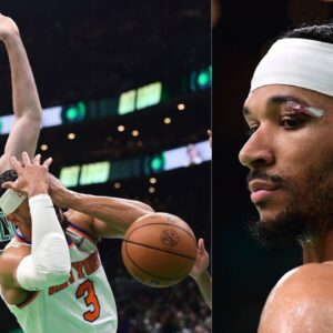 Luke Kornet collides with Josh Hart (L); Josh Hart stitches (R)